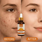relax vitamin c serum